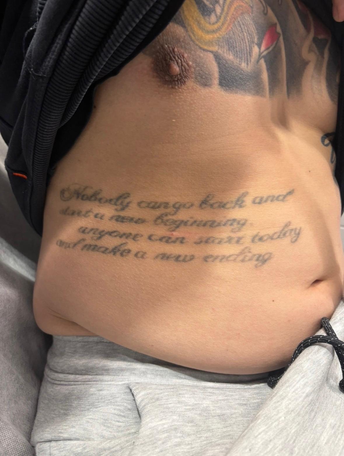 Script tattoo on the torso after 1 laser session