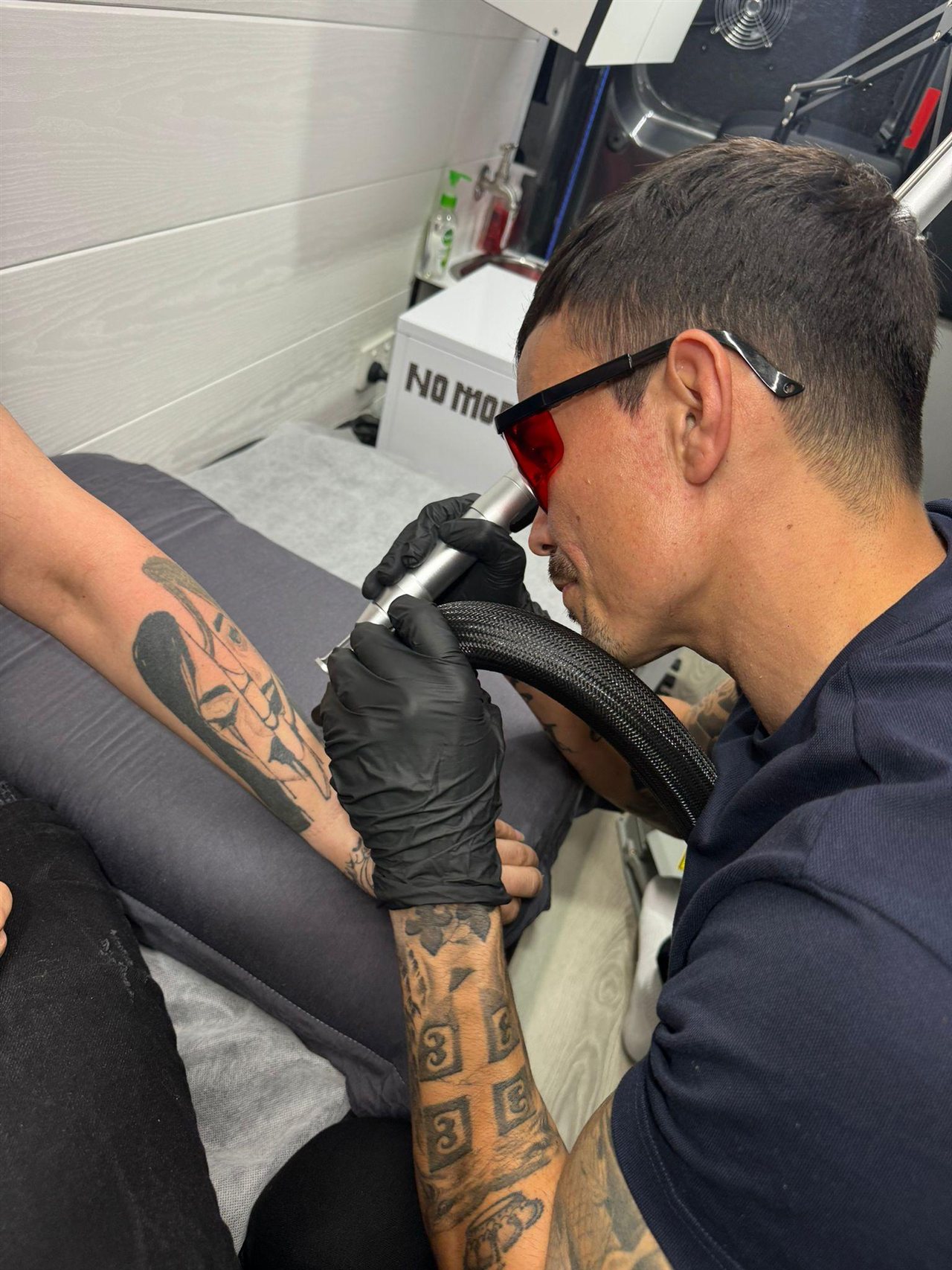 Practitioner treating an arm tattoo with a laser and cooling hose
