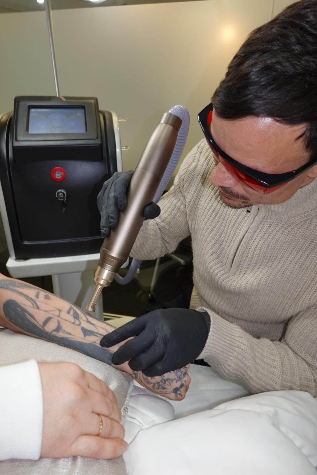 Practitioner using a laser handpiece on an arm tattoo